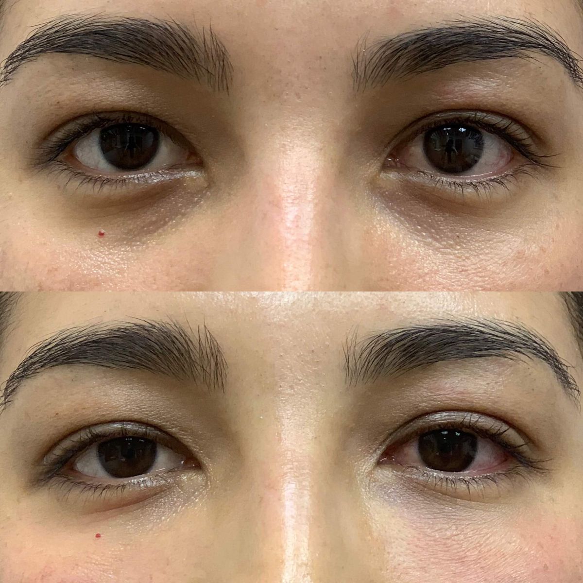 Anti-cernes hydratant pour les yeux