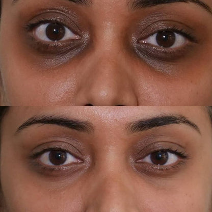 Anti-cernes hydratant pour les yeux 